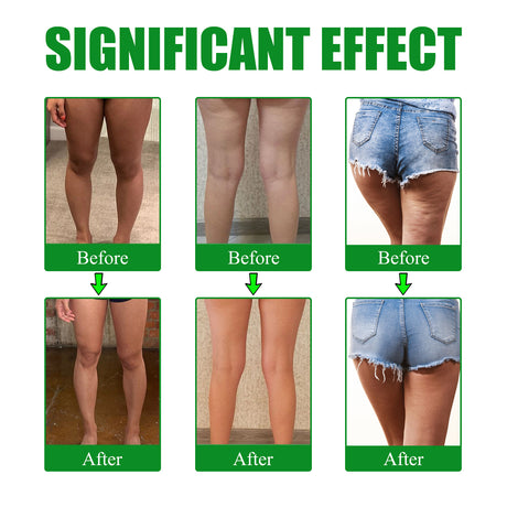 Moxa Leg Lift Paste, Tight Leg Fat, Anti-Orange Peel Shape Lazy People To Create Beautiful Slim Legs - V.I.P Digital Presence