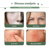 Collagen Serum, Collagen Lighten Spots Moisturizing Brightening Skin Solution