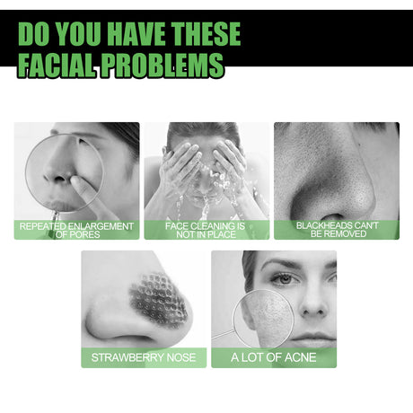 Bamboo Charcoal Blackhead Removal Mask, Deep Cleanse Pores And Acne T-Zone Oil Control With A Peel Mask - V.I.P Digital Presence