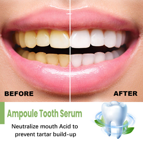 Teeth Whitening Serum To Remove Stains, Bad Breath, Whitening Teeth And Whitening Teeth - V.I.P Digital Presence