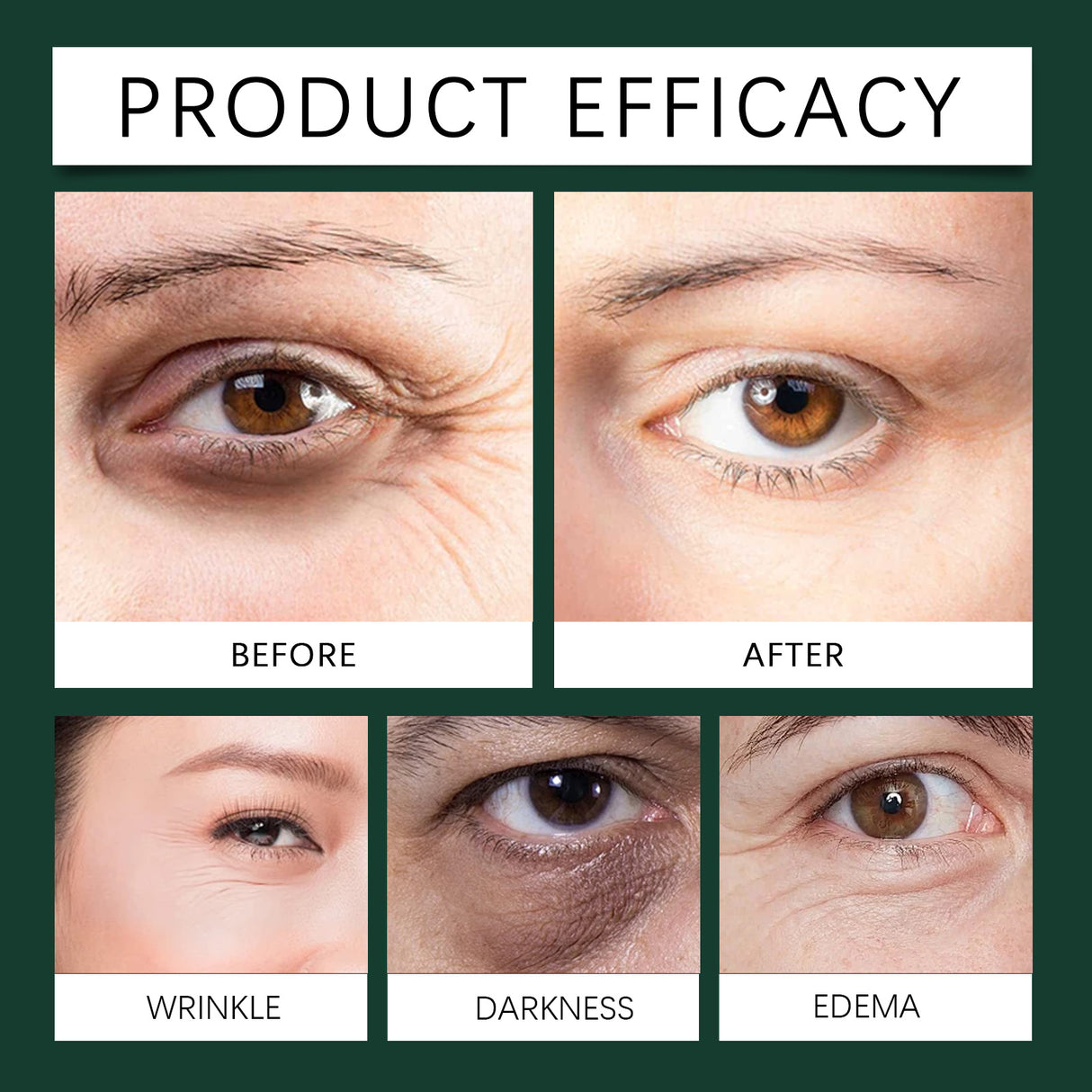 Mint Essence Eye Roller, Fade Fine Lines Crow's Feet Moisturizing Elastic Eye Anti-Wrinkle - V.I.P Digital Presence