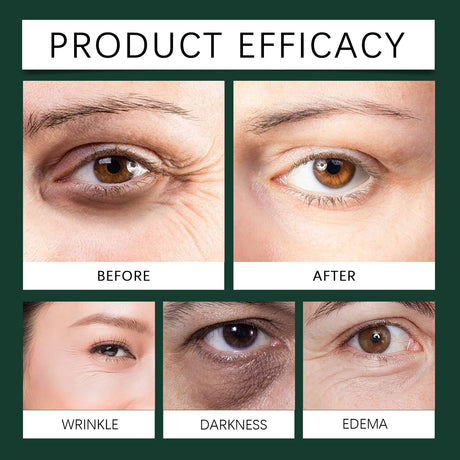 Mint Essence Eye Roller, Fade Fine Lines Crow's Feet Moisturizing Elastic Eye Anti-Wrinkle - V.I.P Digital Presence