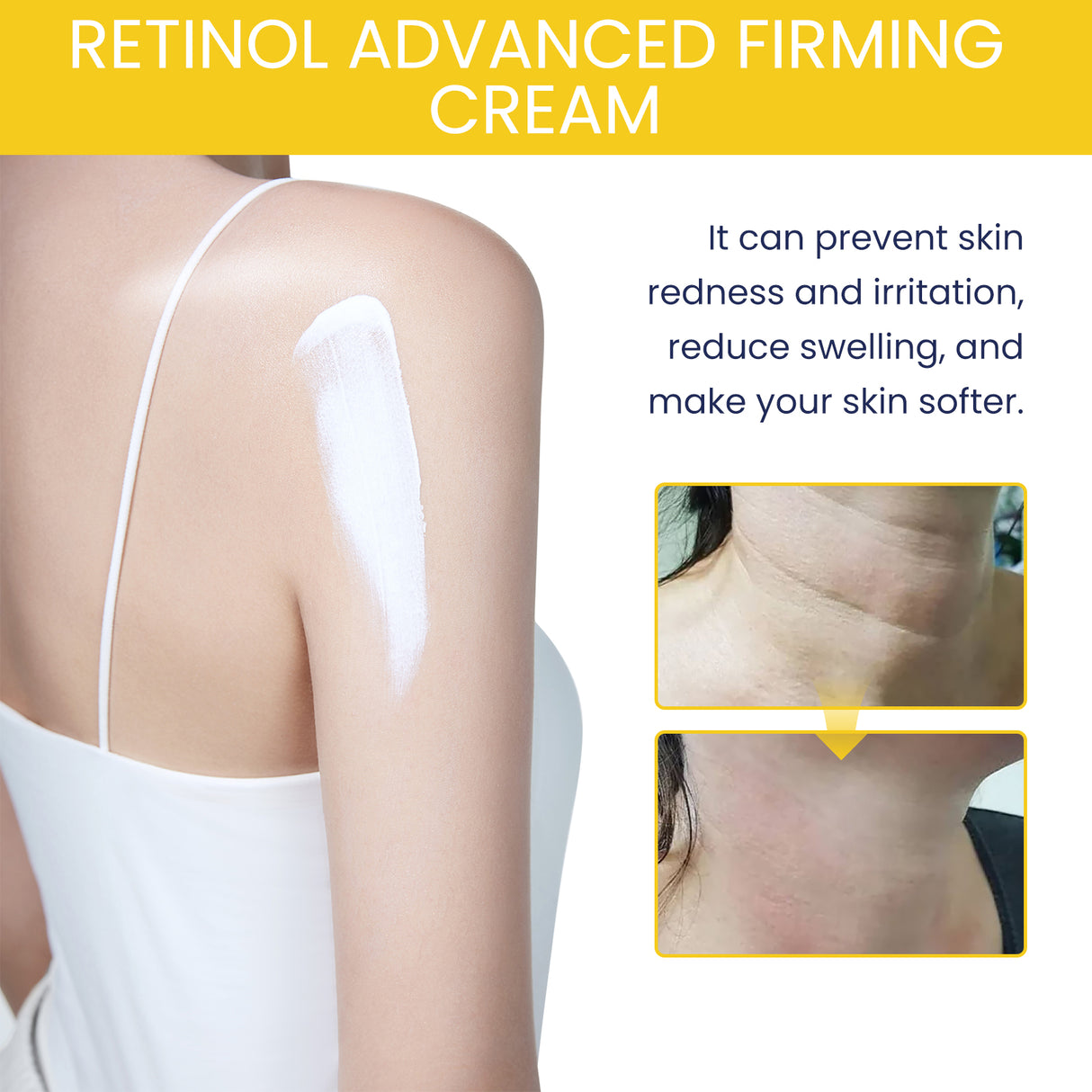 Retinol Advanced Firming Cream, Hydrating And Rejuvenating Brightening Body Smooth Anti-Wrinkle Body Lotion For Skin - V.I.P Digital Presence