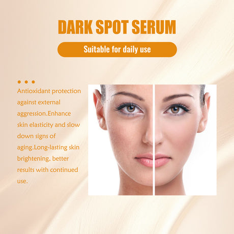 Dark Spot Serum, Hydrating Moist Firming Facial Skin Repair Skin Dark Bright Skin Care Essence - V.I.P Digital Presence