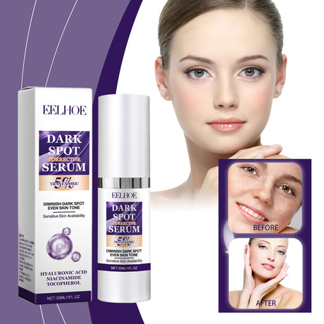 Dark Spot Care Essence, Lightening Dark Spots And Brightening Skin Skin Care Moisturizing Essence - V.I.P Digital Presence