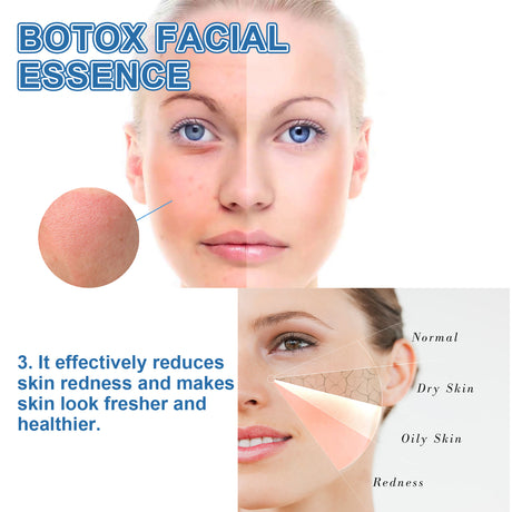 Firming Serum Reduces Fine Lines And Gently Nourishes Tender Facial Skin Firming Serum - V.I.P Digital Presence