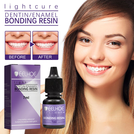 Tooth Gem Decorative Glue, DIY Fashionable Jewelry Bonding Teeth Gems Light Cured Adhesive Glue - V.I.P Digital Presence