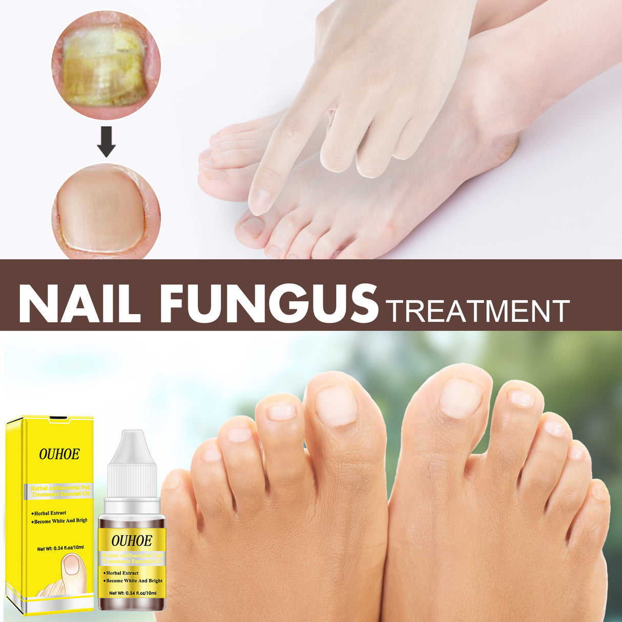 Herbal Antibacterial Nail Treatments Essential Oil, Grey Nail Care Essential Oil Brightening Nail Polish Clean Manicure Foot Care Solution - V.I.P Digital Presence