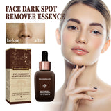 Spot Repair Serum, Lighten Face Spots Repair Dull Skin Hydrating Essence - V.I.P Digital Presence