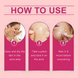 Repair Acne Patch, Facial Cleansing Cover Acne Skin Moisturizing Gentle Skin Cream - V.I.P Digital Presence