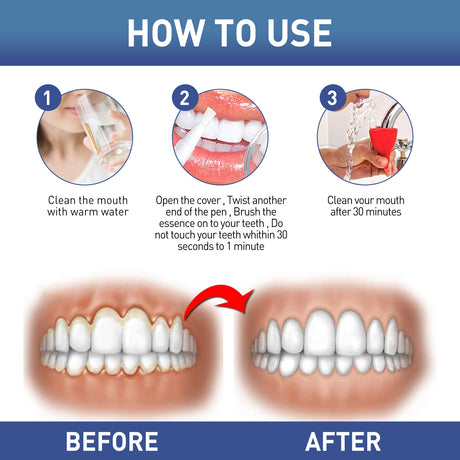 WestMonth Gum Instant Soothing Gel, Relieve Gums Swelling And Pain Clean Teeth Plaque Stains And Whiten Teeth Gel - V.I.P Digital Presence