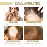 Rosemary Essential Oil For Hair Care, Gentle And Nourishing Hair Care Oil - V.I.P Digital Presence