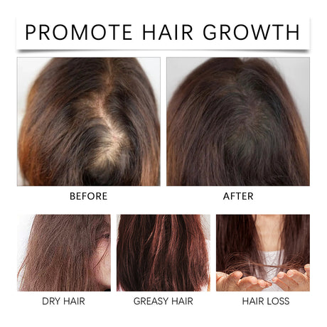Palm Oil Hair Care Essence, Scalp Massage Treatment Repair Dry Hair, Soft And Solid Hair - V.I.P Digital Presence