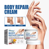 Body Repair Cream, Relieve Peeling Improve Chapped Dry Skin And Remove Dead Skin Moisturize Cream - V.I.P Digital Presence
