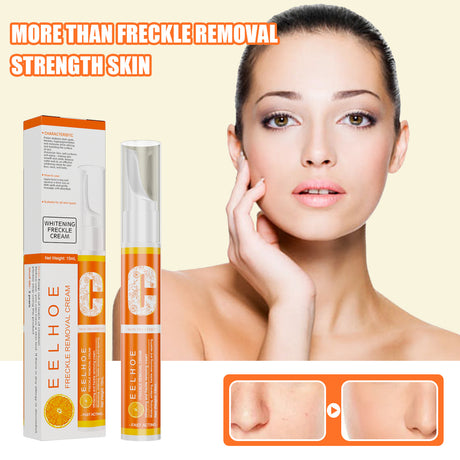 VC Beauty Pen, Moisturizing Facial Skin, Reduce Spots And Melanin Skin Beauty Pen - V.I.P Digital Presence