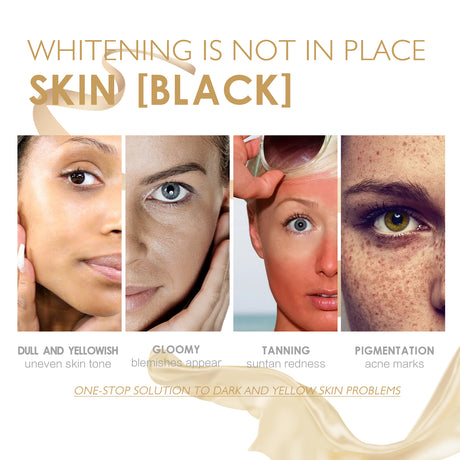 White Truffle Moisturizing Spray, Moisturizing And Brightening Whitening Essence Spray - V.I.P Digital Presence