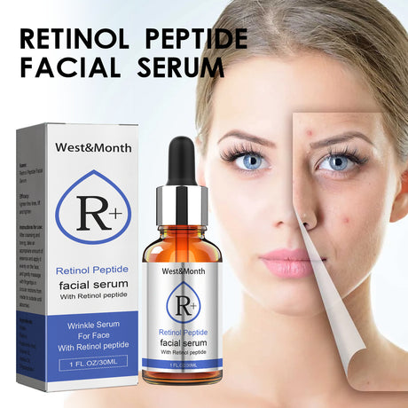 Retinol Face Serum, Lighten Fine Lines, Moisturize Tender, White, Firming And Anti-Wrinkle Beauty Solution - V.I.P Digital Presence