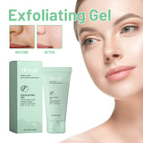 Exfoliating Gel, Mildly Clean Silent Black Mouth Contractive Pore Chamfer Bright Skin Gel - V.I.P Digital Presence