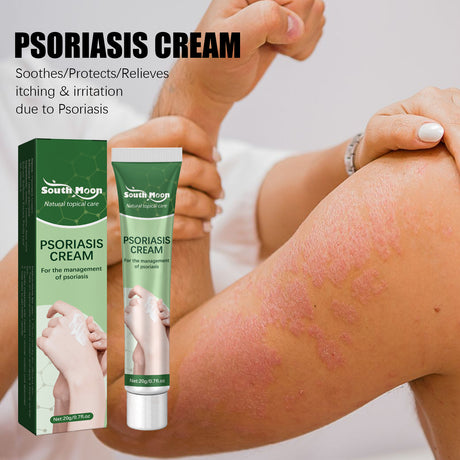 Psoriasis Cream, Relieve Itchy Skin Of Hands And Feet Skin Moss Body Skin Care Cream - V.I.P Digital Presence