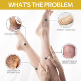 Bee Venom Leg Care Cream Relieves Leg Discomfort, Pamper And Moisturize Skin Body Care Cream - V.I.P Digital Presence