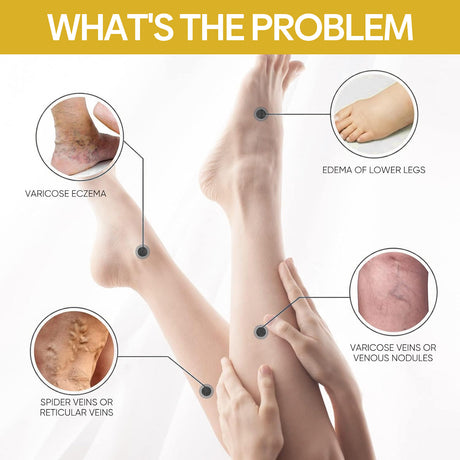 Bee Venom Leg Care Cream Relieves Leg Discomfort, Pamper And Moisturize Skin Body Care Cream - V.I.P Digital Presence