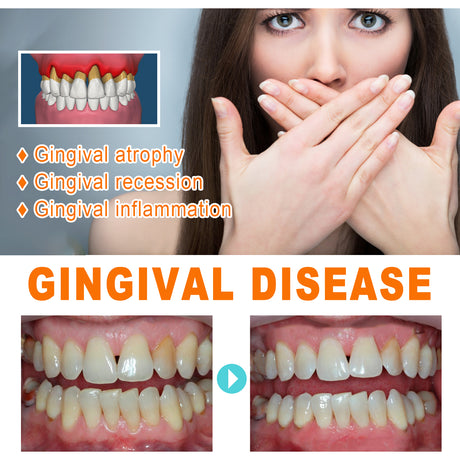 Tooth Repair Essence, Cleaning Teeth Stains Tartar Care Gums Oral Care Essence - V.I.P Digital Presence