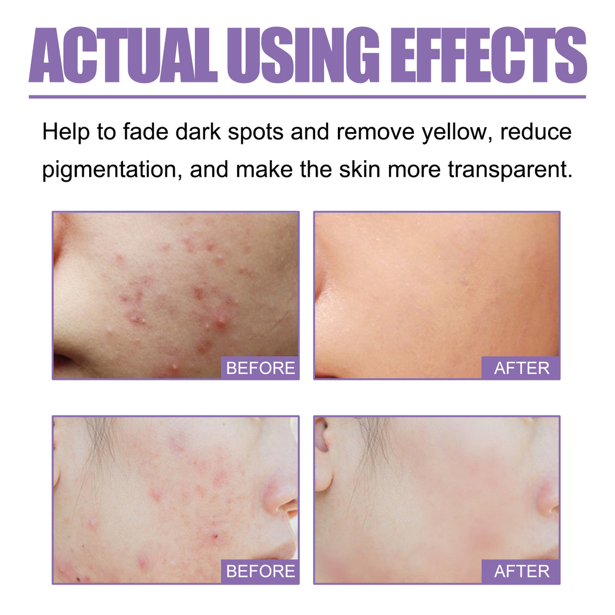 Lavender Oil Control Acne-Cleansing Soap For Cleansing Facial Skin Pores Oil Control Acne-Moisturizing Cleansing Soap - V.I.P Digital Presence