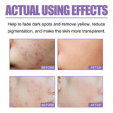 Lavender Oil Control Acne-Cleansing Soap For Cleansing Facial Skin Pores Oil Control Acne-Moisturizing Cleansing Soap - V.I.P Digital Presence