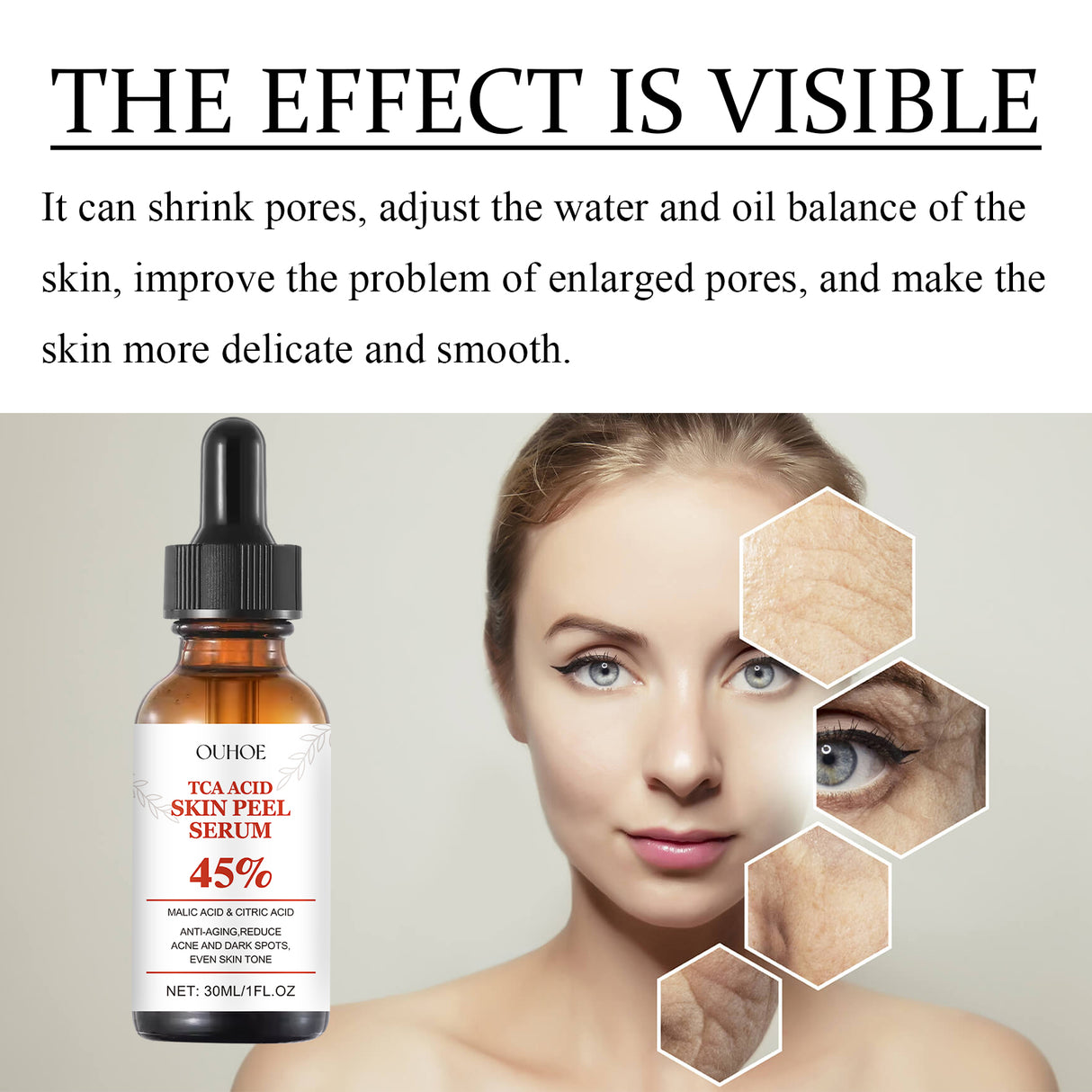 TCA Acid Skin Peel Serum - V.I.P Digital Presence