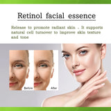 Retinol Serum, Face Anti-Wrinkle Firming Brightening Soft And Smooth Skin Serum - V.I.P Digital Presence