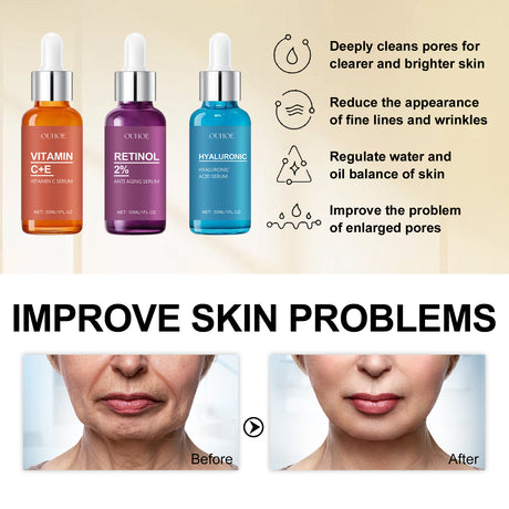 Grape Fruit Essence, Moisturizing, Tender, Firming, Smoothing, Fine Lines And Anti-Wrinkle Skin Care Essence - V.I.P Digital Presence