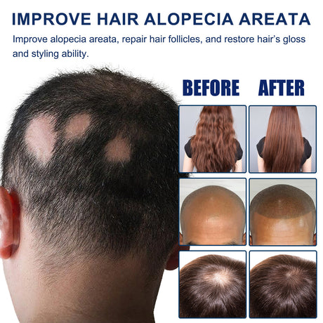 Alopecia Areata Care Set, Clean Scalp Supple Care Frizzy Hair Wash And Care Gift Set - V.I.P Digital Presence