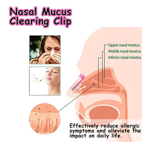Nasal Mucus Clearing Clip, Deep Cleaning Nasal Mucus To Relieve Nasal Congestion And Discomfort Breathing Smooth And Comfortable - V.I.P Digital Presence