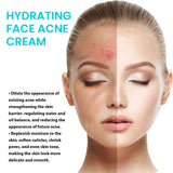 Brightening Anti-Acne Cream, Lighten Acne Pimples, Shrink Pores, Moisturize Skin Brightening Cream