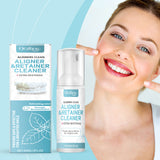 Braces Cleansing Mousse, Teeth And Mouth Fresher Corrector Gentle Cleansing Foam - V.I.P Digital Presence