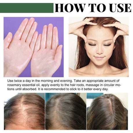 Rosemary Oil Capsules, Nourish Hair Roots Prevent The Loss Of Solid Hair And Hair Moisturizing Hair Care Essential Oil - V.I.P Digital Presence