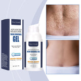 Skin Repair Gel, Gently Nourishes Body Skin And Naturally Shines Skin Repair Gel - V.I.P Digital Presence
