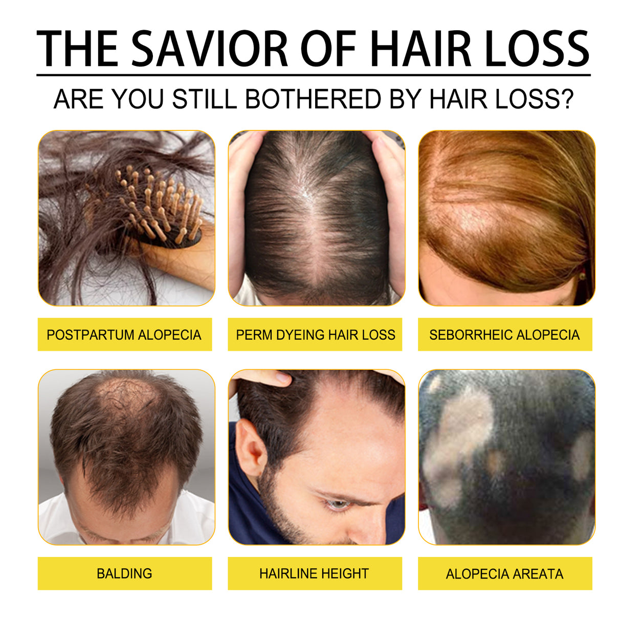 Black Seed Oil Essence To Improve Dry Hair, Nourish And Repair Damaged Hair And Prevent Hair Loss - V.I.P Digital Presence