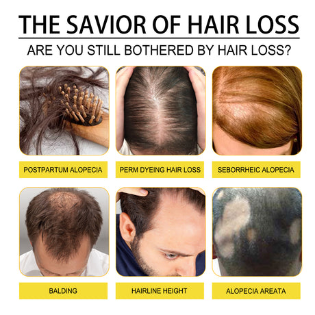 Black Seed Oil Essence To Improve Dry Hair, Nourish And Repair Damaged Hair And Prevent Hair Loss - V.I.P Digital Presence