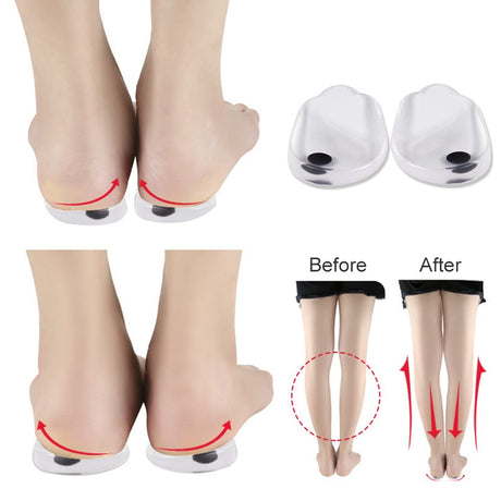 2PCS Insoles Correction Shoe Inserts Pads Effective O/X Type Leg Bowed Legs Knee Valgum Straightening for Women Men Health Care - V.I.P Digital Presence