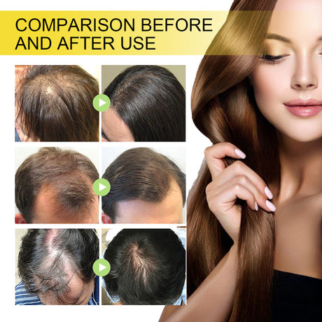 Black Seed Oil Essence To Improve Dry Hair, Nourish And Repair Damaged Hair And Prevent Hair Loss - V.I.P Digital Presence