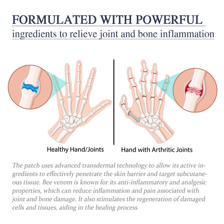 Bee Venom Joint Cream, Relieves Hands Legs Bones Knees Lumbar Spine Sedentary Joint Pain Body Care Cream - V.I.P Digital Presence