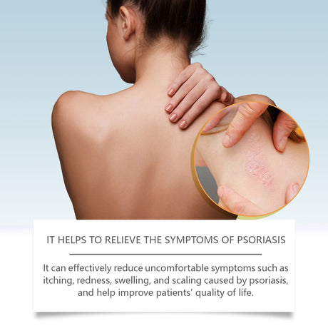 Bee-Venom Cowhide Moss Care Cream Moisturizes And Restores Itchy Red And Swollen Hands And Feet Skin Care Cream - V.I.P Digital Presence