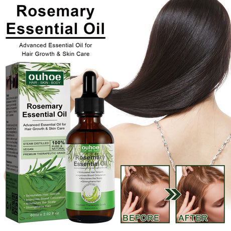 Rosemary Hair Dense Essential Oil, Prevent Hair Breakage And Hair Loss Strong, Strong And Solid Hair Moisturizing Root Dense Essential Oil - V.I.P Digital Presence