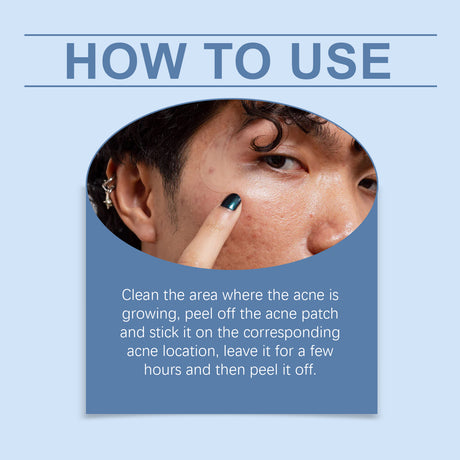 Moon Acne Patch Repair Acne Skin Breathable Facial Skin Gentle Cleansing Patch - V.I.P Digital Presence