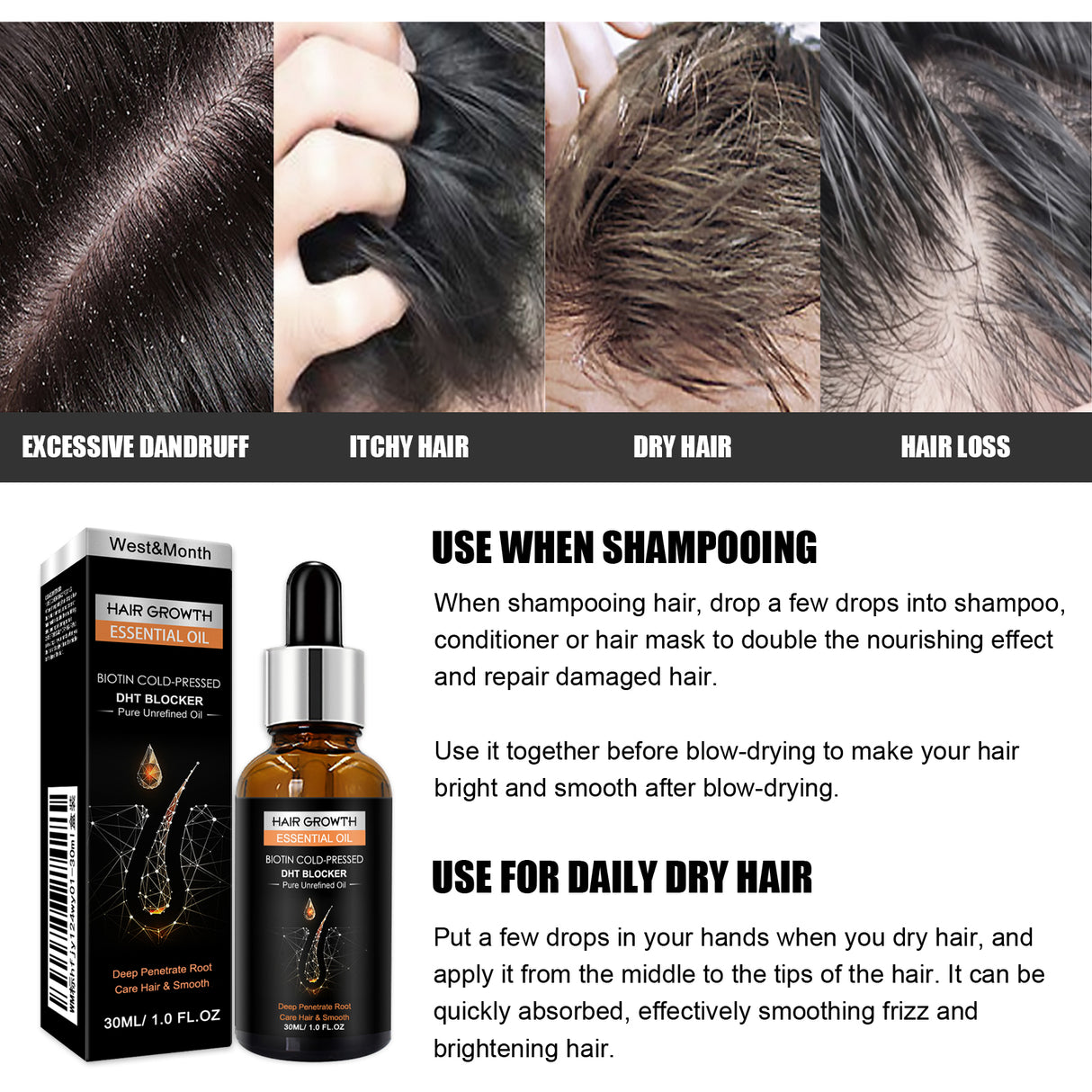 Hair Growth Essential Oil, Dense Hair Growth Repair Dry Hair And Moisture Hair Essence - V.I.P Digital Presence