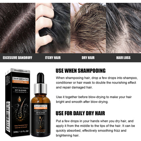 Hair Growth Essential Oil, Dense Hair Growth Repair Dry Hair And Moisture Hair Essence - V.I.P Digital Presence