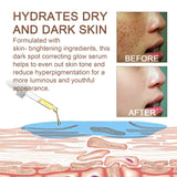 Dark Spot Whitening Essence Lightening Dark Spot Repair Firming Whitening Skin Moisturizing Essence