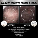 Moving Hair Growth Treatment, Repair Frizzy, Smooth And Dense Hair Scalp Care Heating Massage Cap - V.I.P Digital Presence