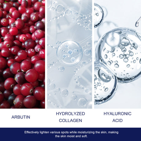 Skin Genesis Spot Whitening Cream, Filling Water To Moisten Soft Delicate Chun White Brighten The Melanin Of Skin Cream - V.I.P Digital Presence